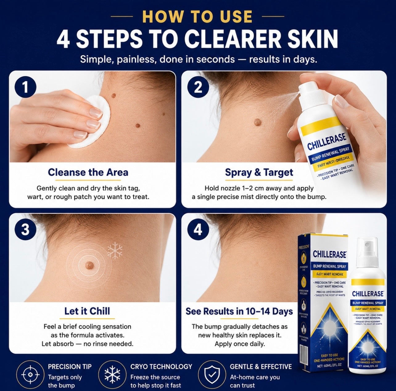 ChillErase Bump Renewal spray