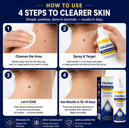ChillErase Bump Renewal spray